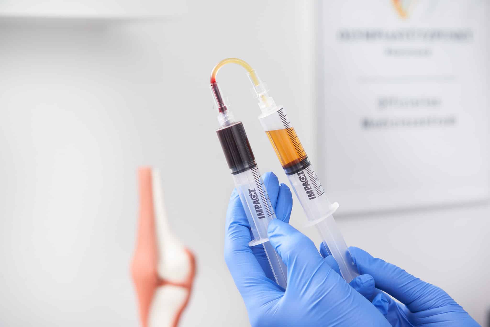 Featured image for “Interview mit Dr. Carsten Braune: Wie Eigenblut­therapie die Selbstheilungs­kräfte des Körpers aktivieren kann”